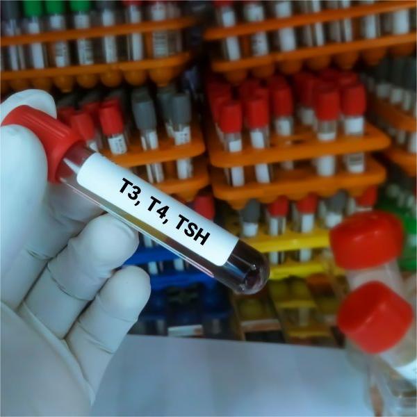 Etiquetas RFID de congelación profunda CryoRFID para viales